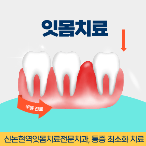 김포치과 김포시 치과 잇몸치료